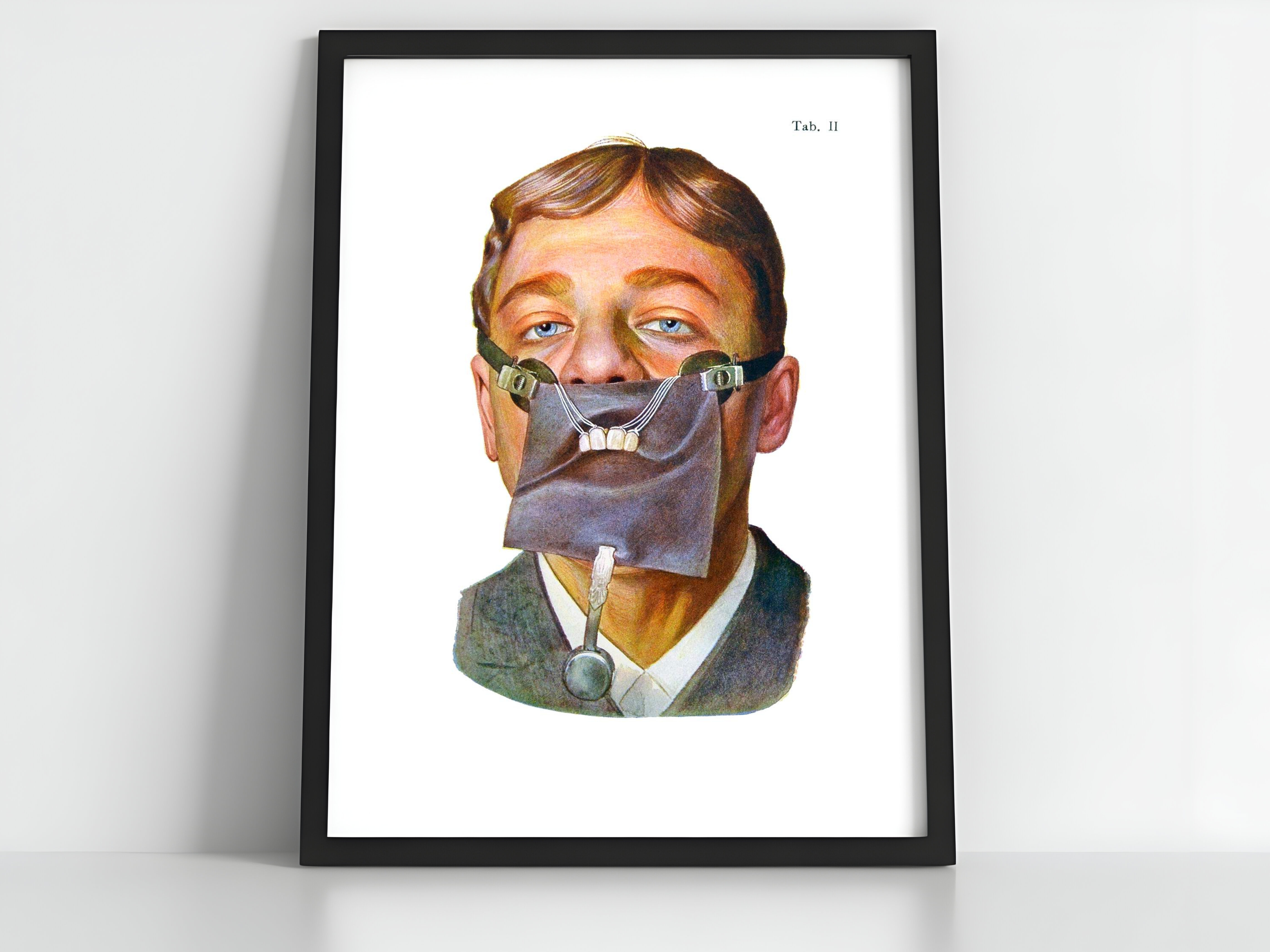 Dental Dam Applied to Upper Teeth